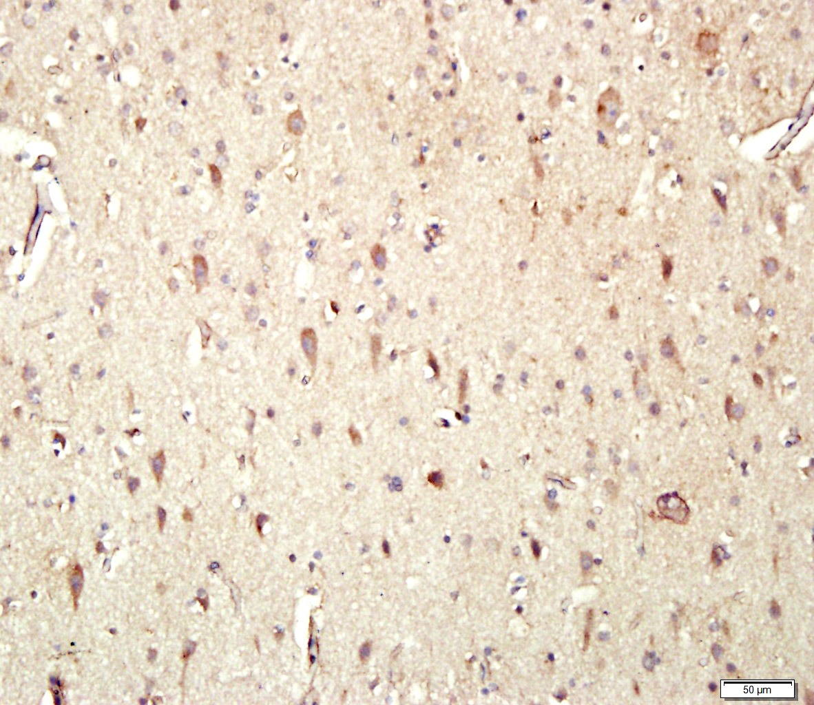 Anti-ADRB1 Polyclonal Antibody 2