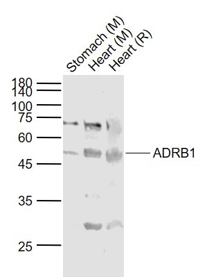 Anti-ADRB1 Polyclonal Antibody 2