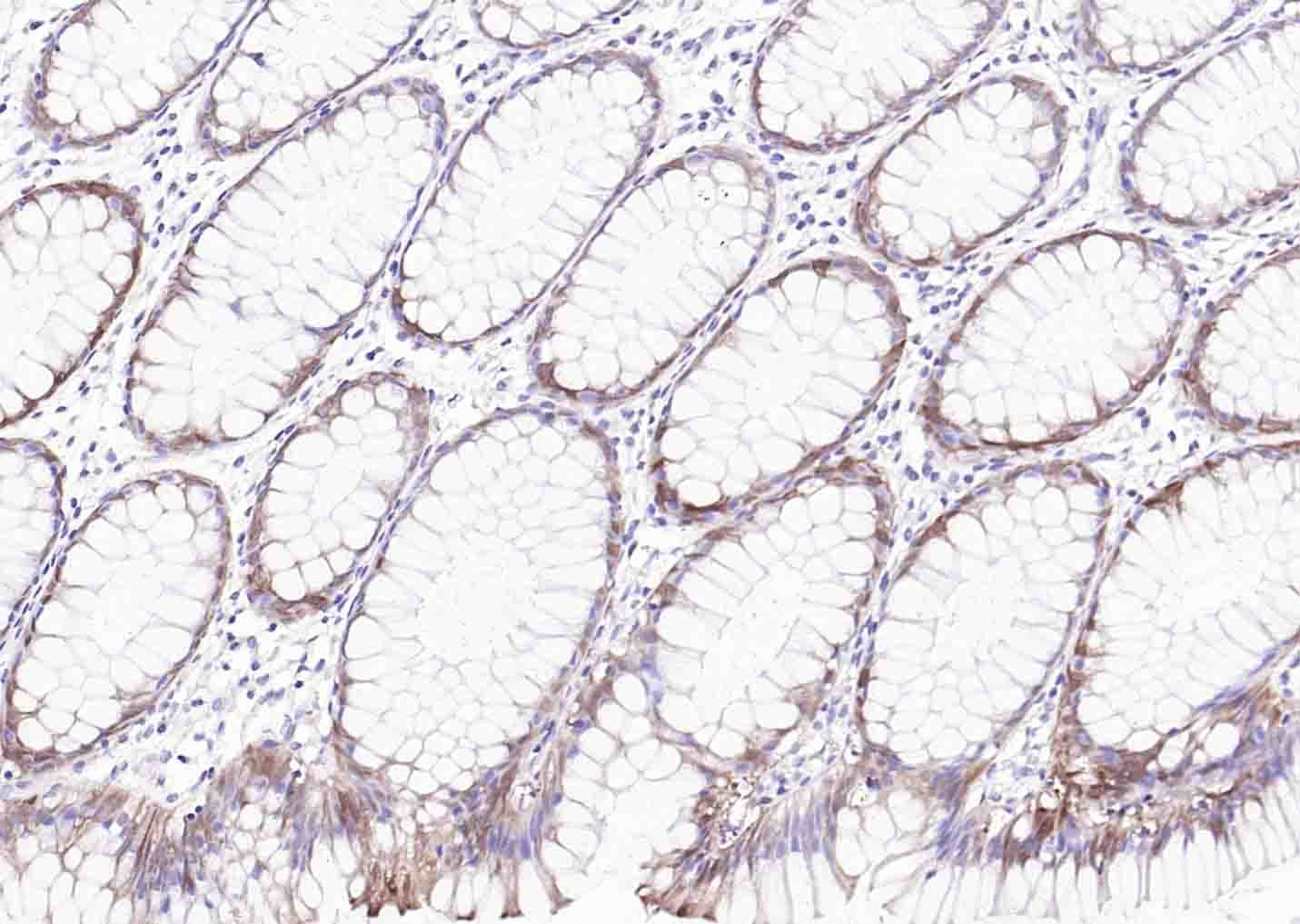 Anti-ADIPOR2 Polyclonal Antibody