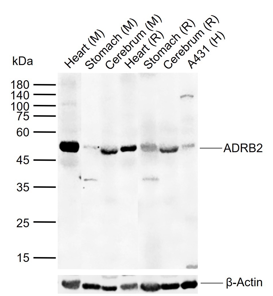Anti-ADRB2 Polyclonal Antibody
