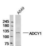 Anti-Adenylate cyclase 1 Polyclonal Antibody