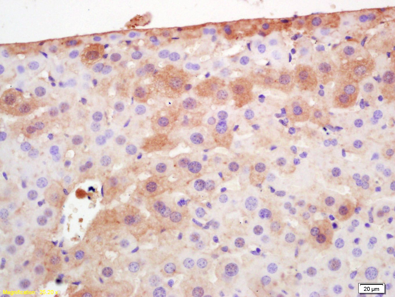 Anti-Adiponectin Polyclonal Antibody