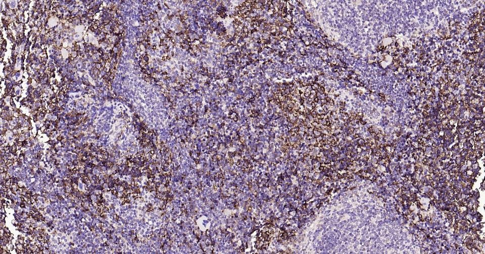 Anti-ADGRE1 Polyclonal Antibody 2