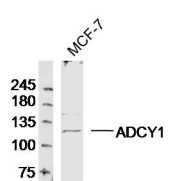 Anti-Adenylate cyclase 1 Polyclonal Antibody