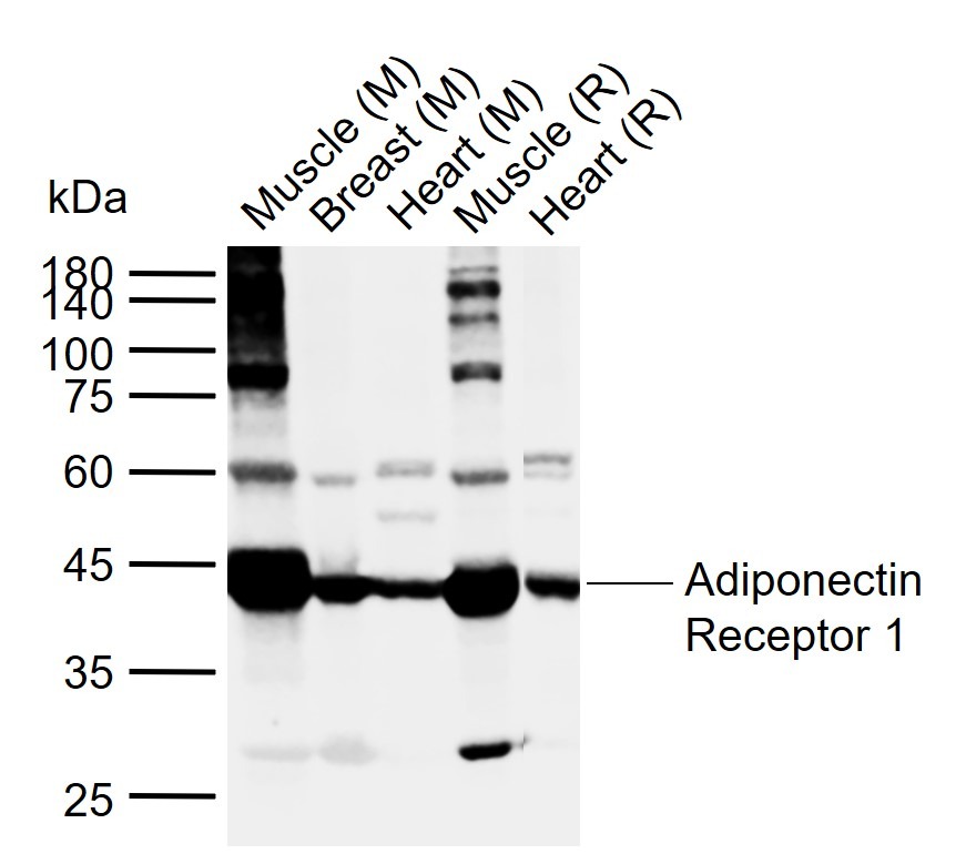 Anti-ADIPOR1 Polyclonal Antibody