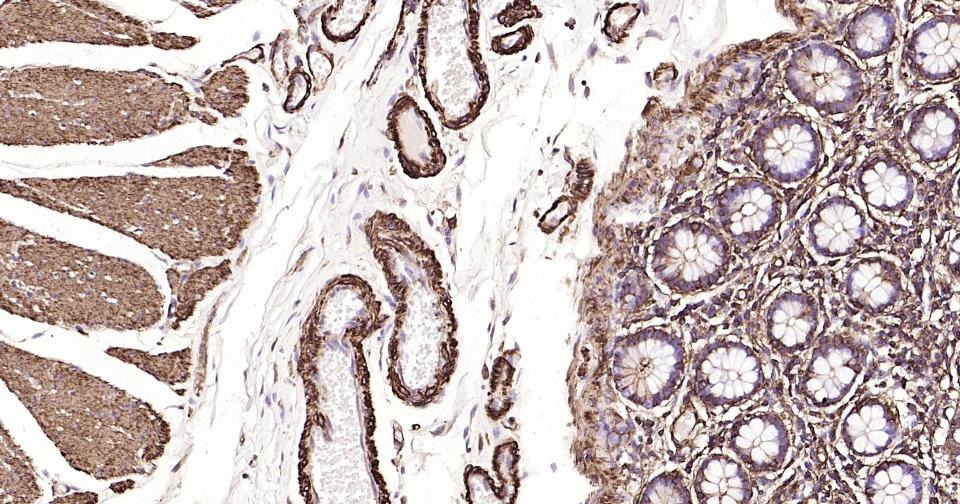 Anti-ACTA2 Antibody (3P485)