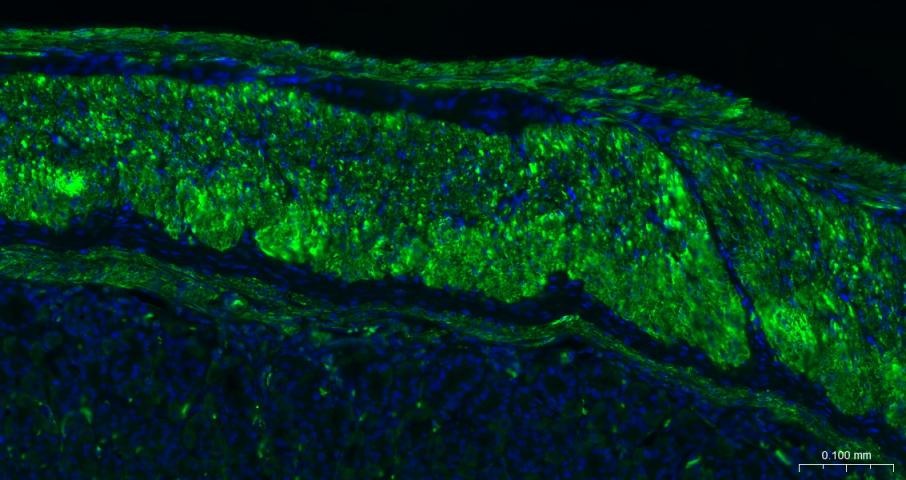 Anti-ACTA2 Antibody (3P485)