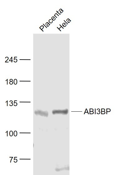 Anti-ABI3BP Polyclonal Antibody