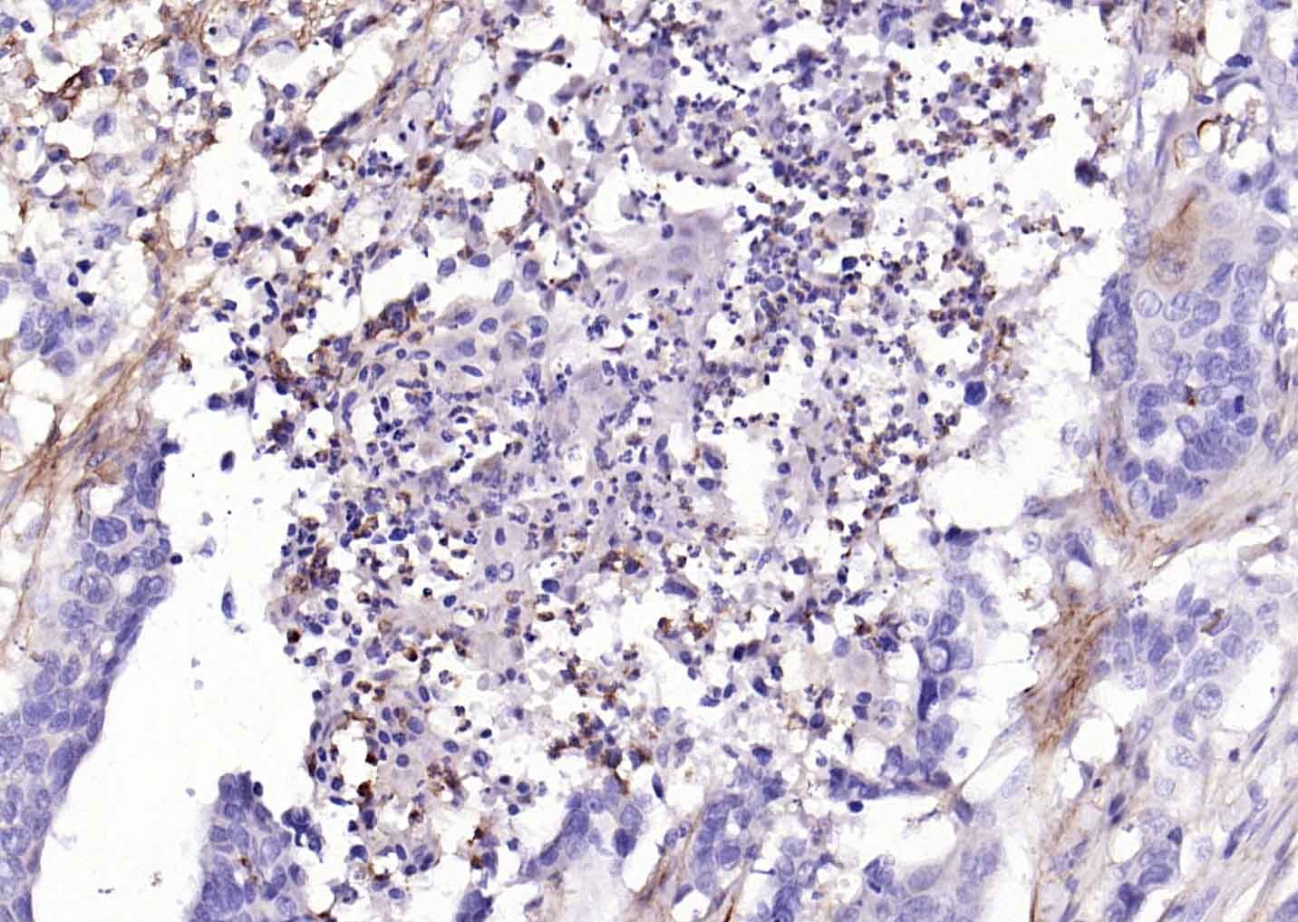 Anti-ACE2 Polyclonal Antibody