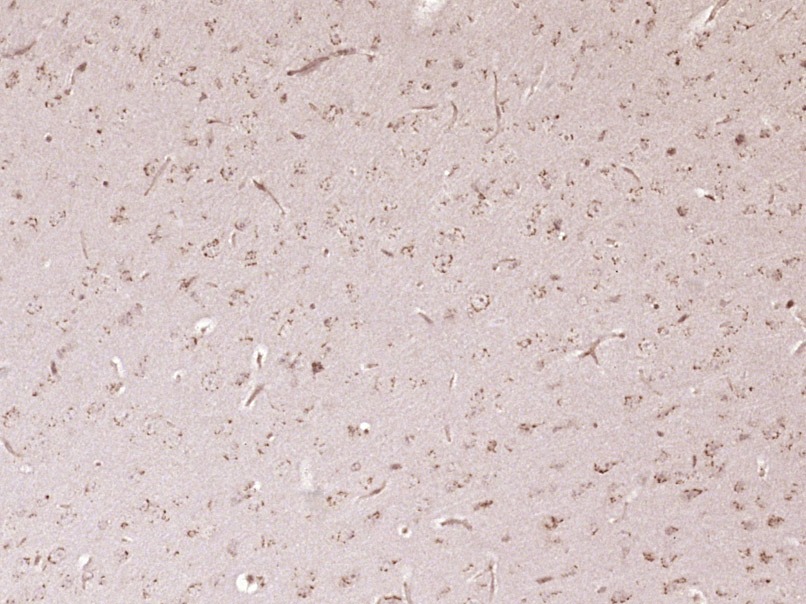 Anti-4EBP1 Polyclonal Antibody