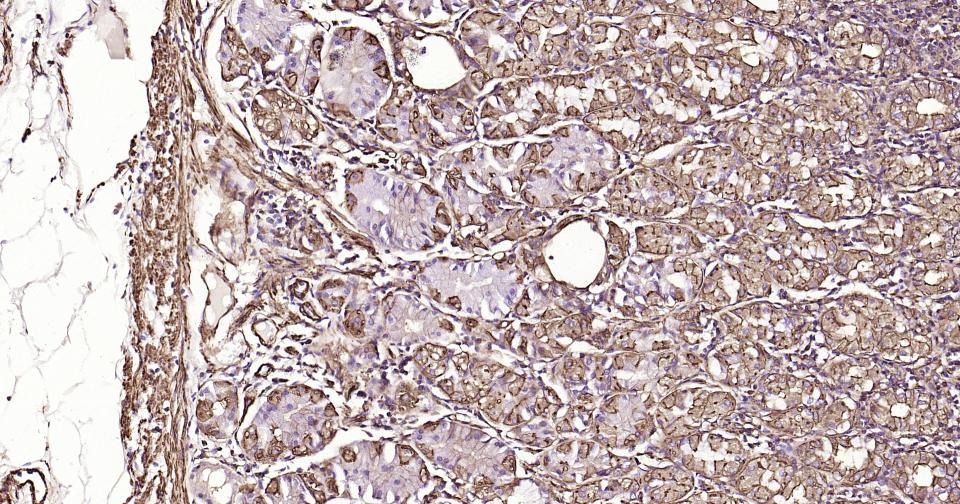 Anti-ACTA2 Antibody (3P485)
