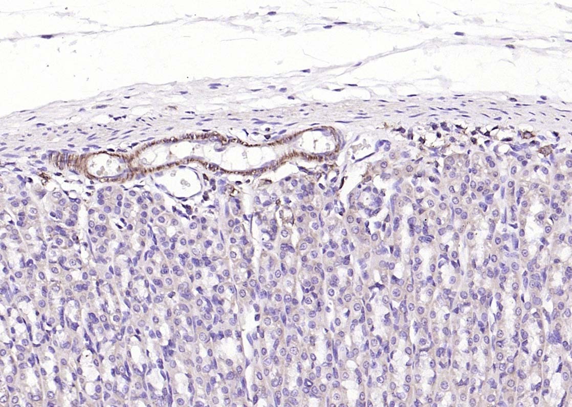 Anti-ACTA2 Polyclonal Antibody