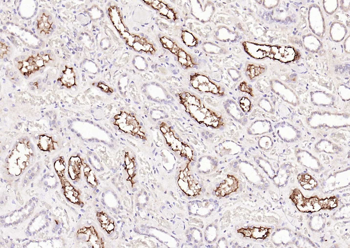 Anti-ACE2 Polyclonal Antibody