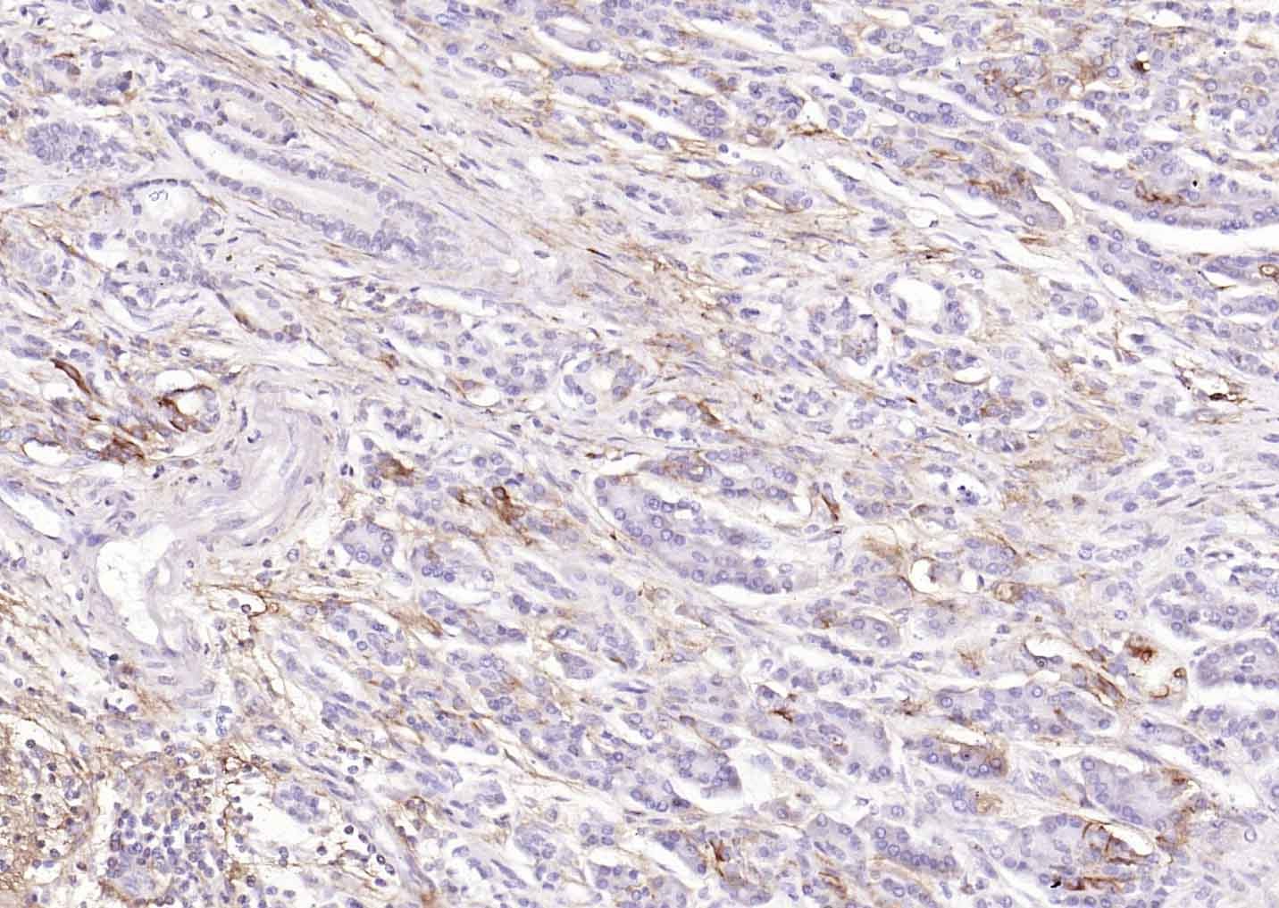 Anti-ACE2 Polyclonal Antibody