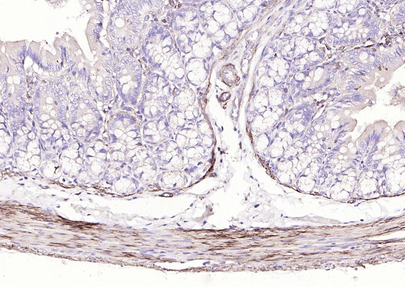 Anti-ACTA2 Polyclonal Antibody
