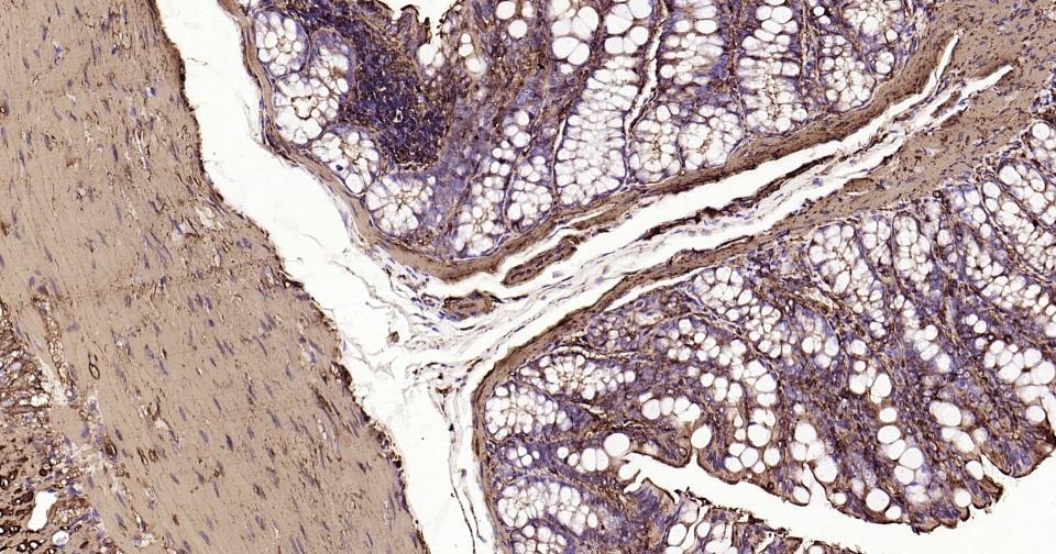 Anti-ACTA2 Antibody (3P485)