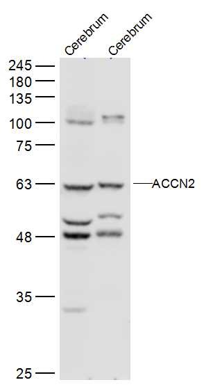 Anti-ACCN2 Polyclonal Antibody
