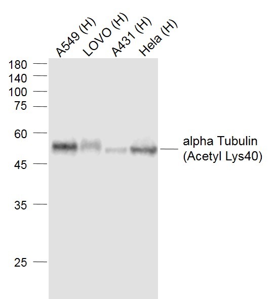 Anti-Acetyl-Alpha Tubulin (Lys40) Antibody (1U664)