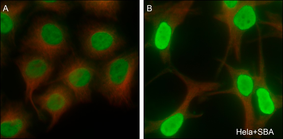 Anti-Acetyl-Histone H4 (Lys12) Antibody (8Z904)