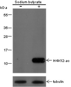 Anti-Acetyl-Histone H4 (Lys12) Antibody (8Z904)