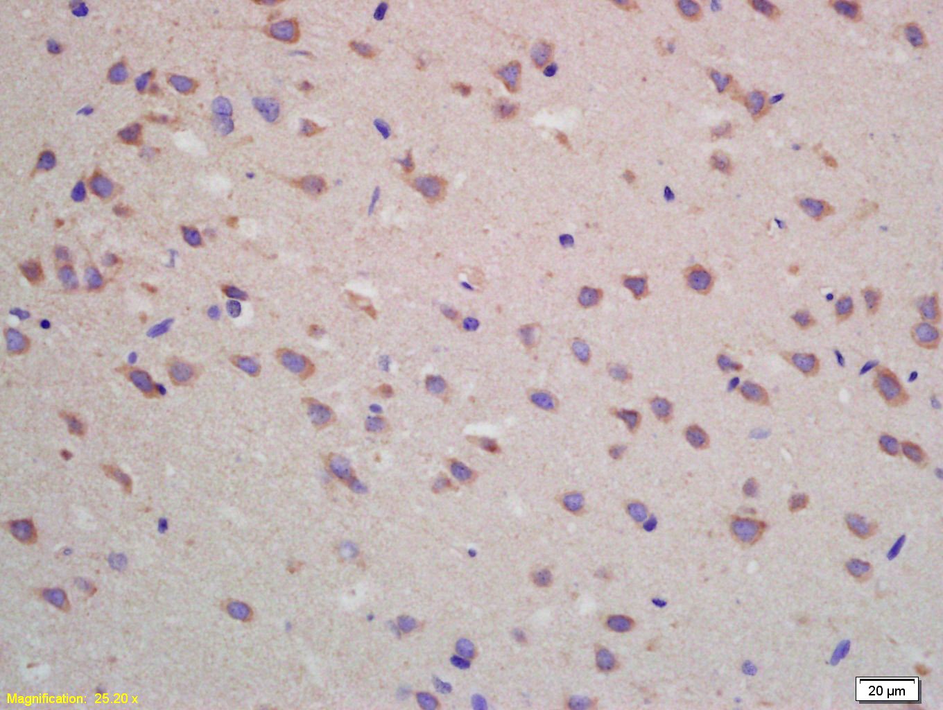 Anti-A1AR Polyclonal Antibody