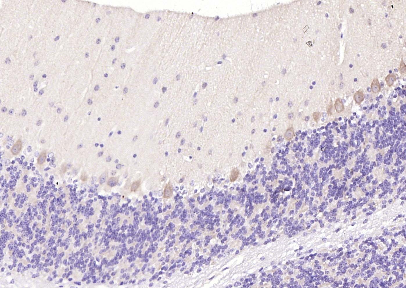 Anti-5HT7 Receptor Polyclonal Antibody