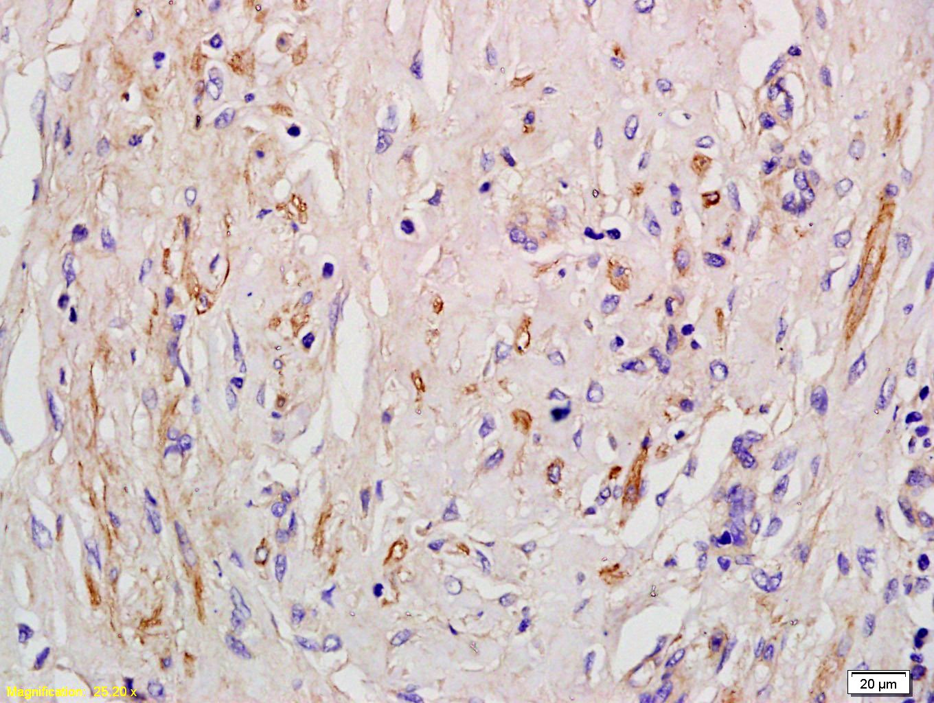 Anti-AGTR1 Polyclonal Antibody