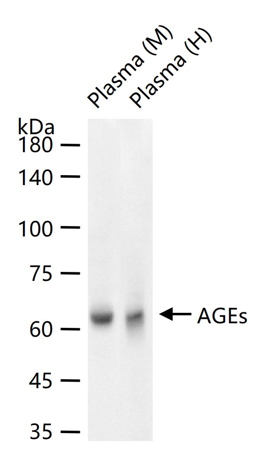 Anti-AGEs Polyclonal Antibody