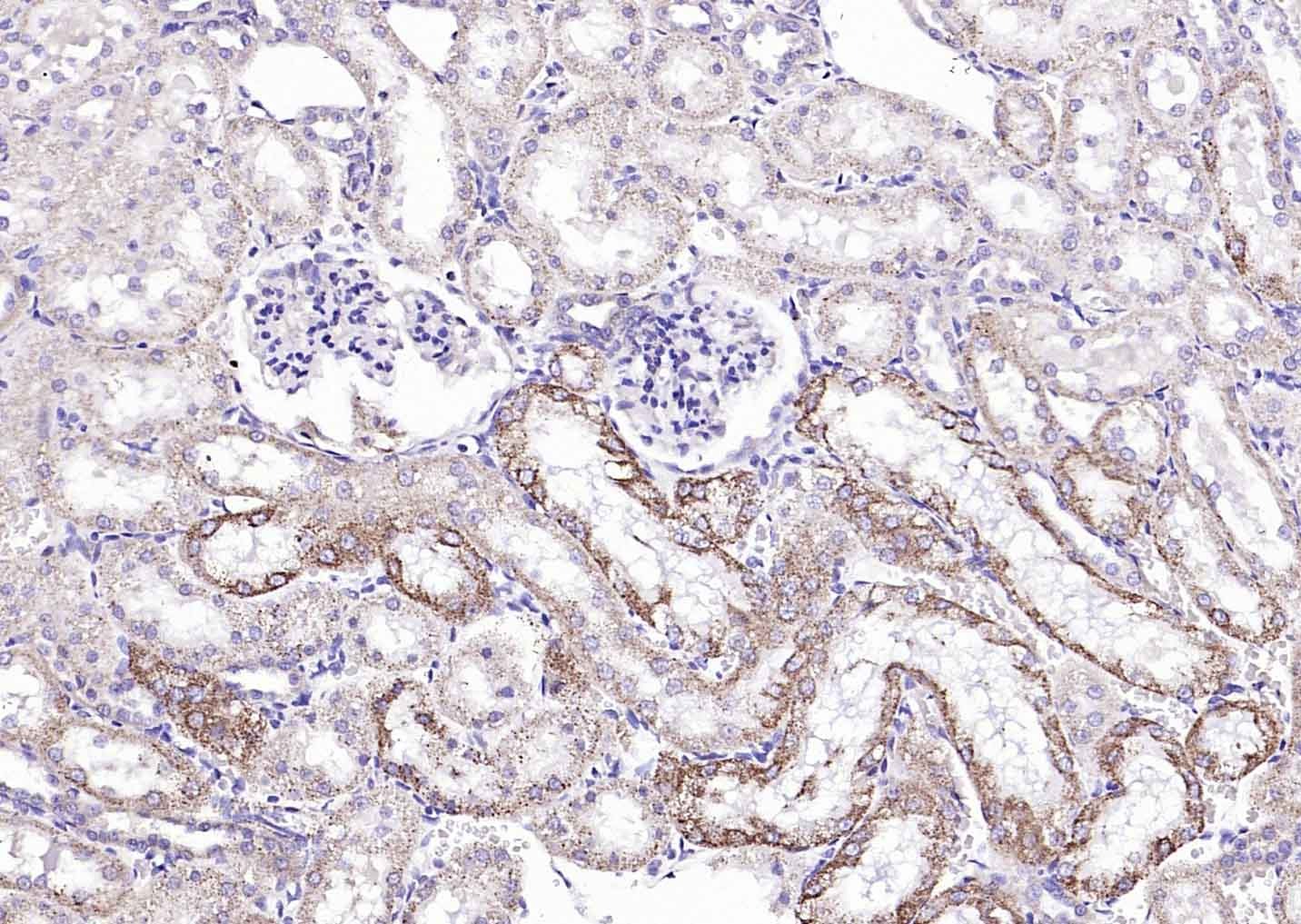 Anti-Angiopoietin-1 Polyclonal Antibody