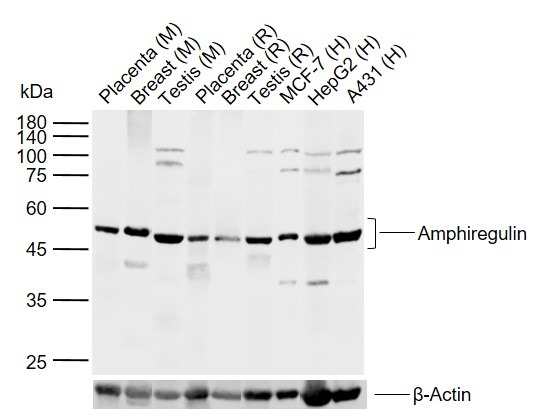 Anti-Amphiregulin Polyclonal Antibody