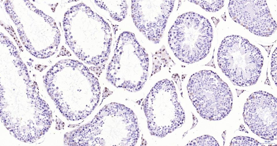 Anti-Androgen receptor Polyclonal Antibody