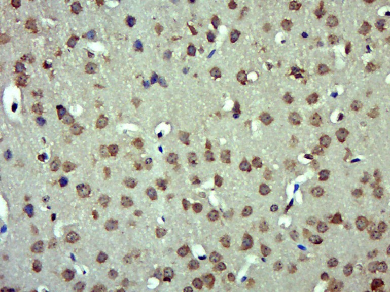 Anti-Angiotensin II Polyclonal Antibody