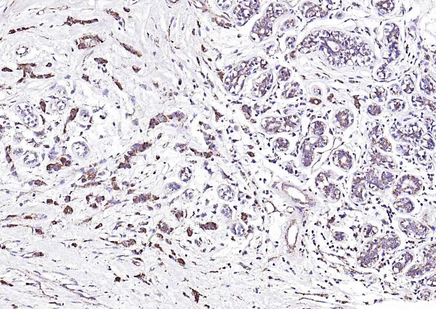 Anti-Angiopoietin-1 Polyclonal Antibody