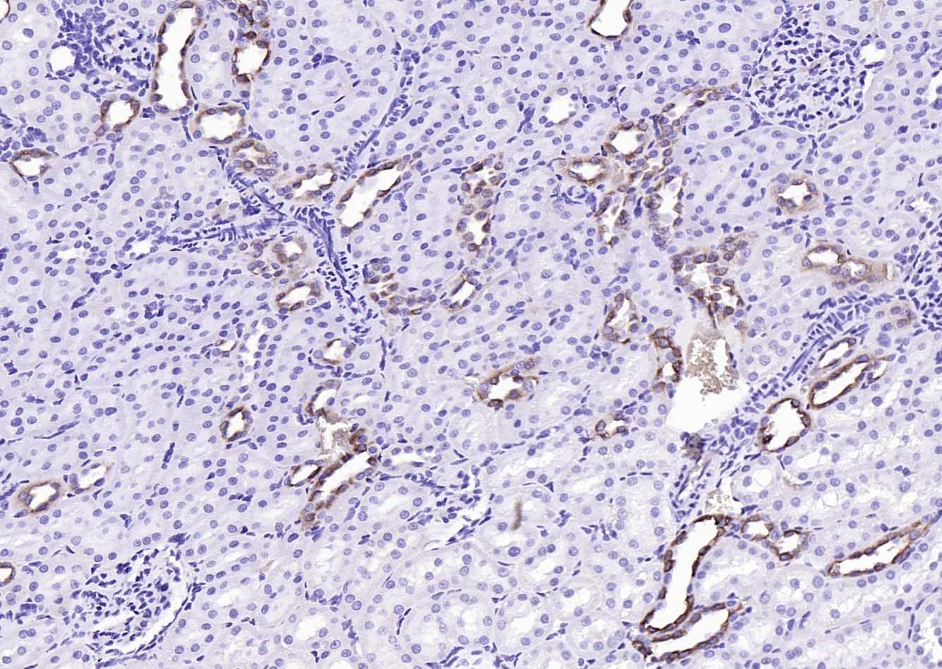 Anti-AGTR1 Polyclonal Antibody 2