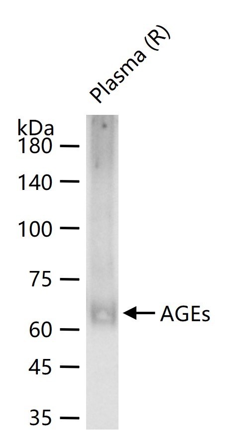 Anti-AGEs Polyclonal Antibody