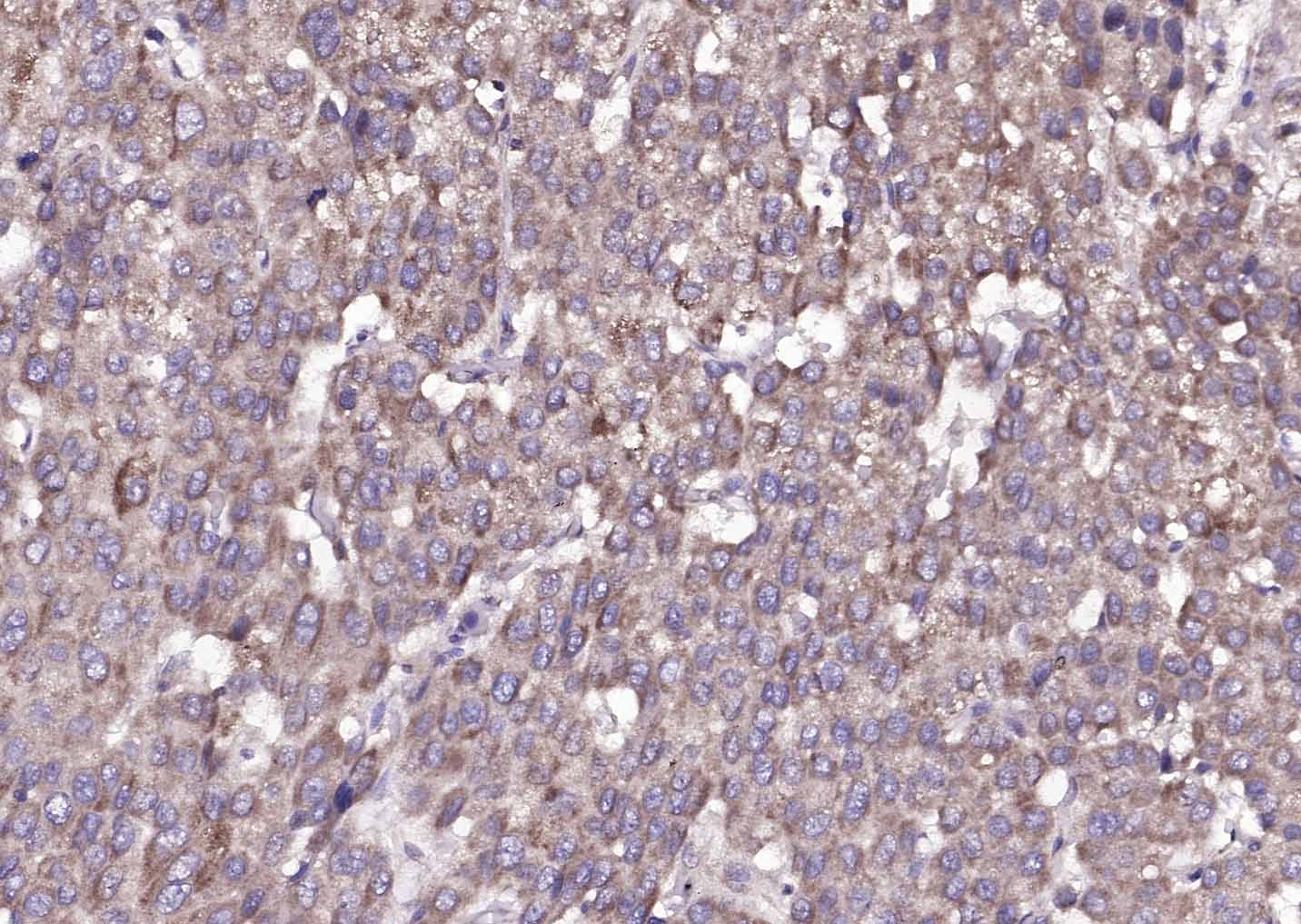 Anti-Amphiregulin Polyclonal Antibody