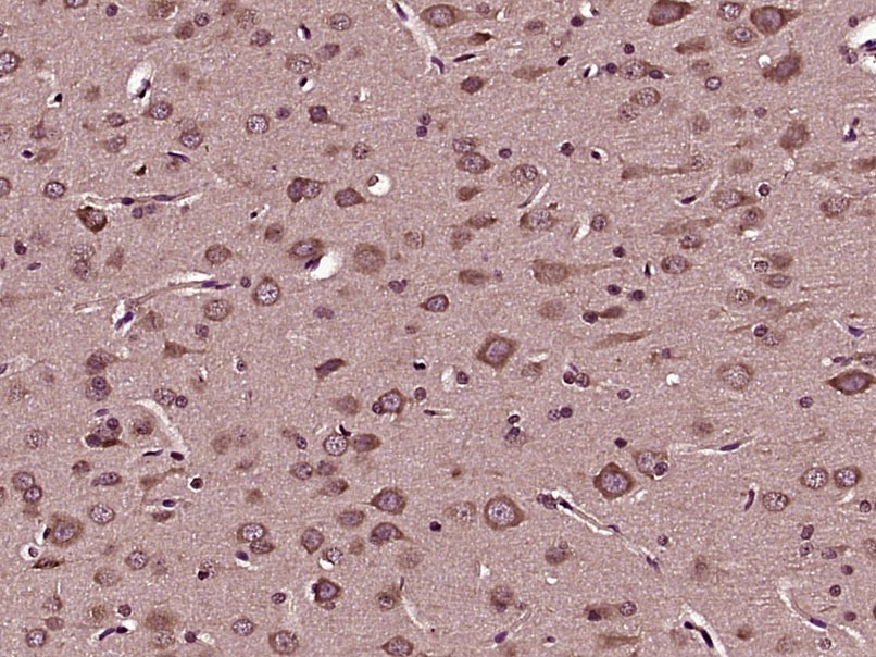 Anti-AGTR1 Polyclonal Antibody 2