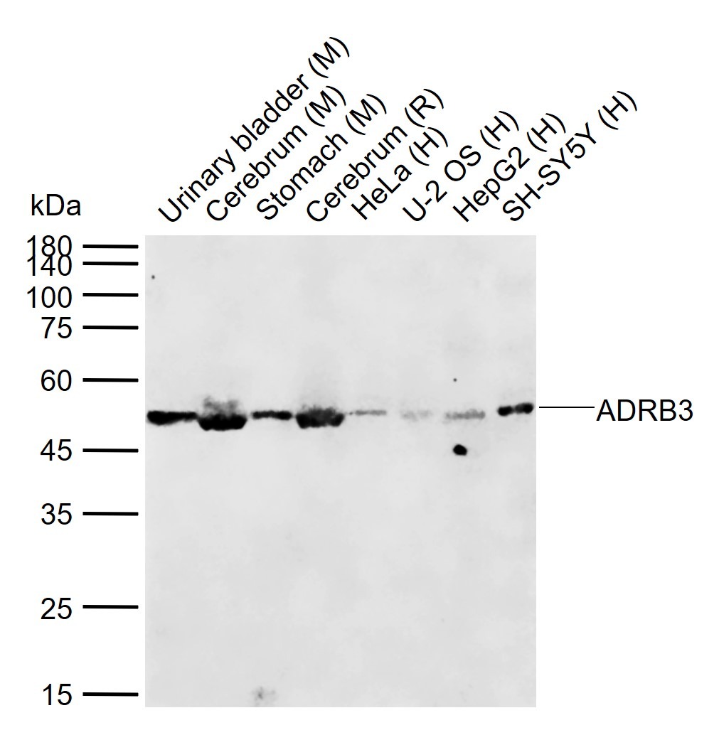 Anti-ADRB3 Polyclonal Antibody 2