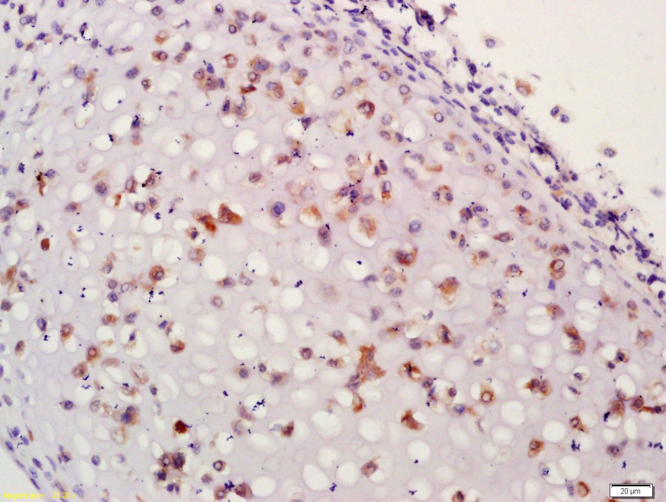 Anti-Aggrecan Polyclonal Antibody 2