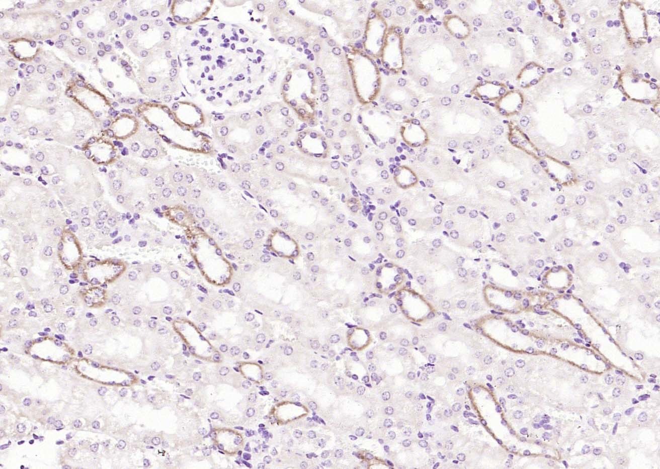 Anti-AGTR1 Polyclonal Antibody