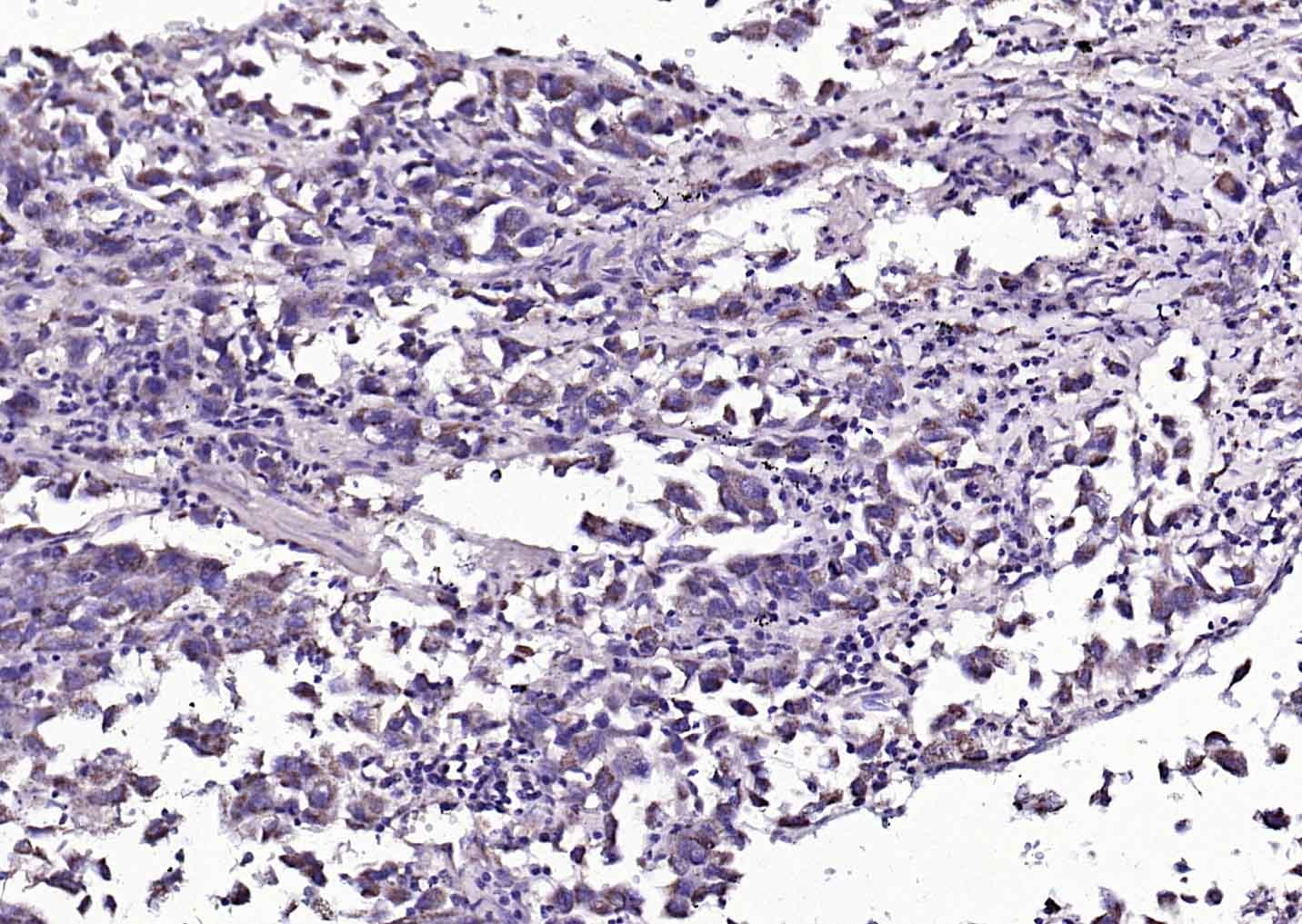 Anti-Angiopoietin-1 Polyclonal Antibody