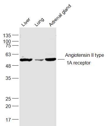 Anti-AGTR1 Polyclonal Antibody 2