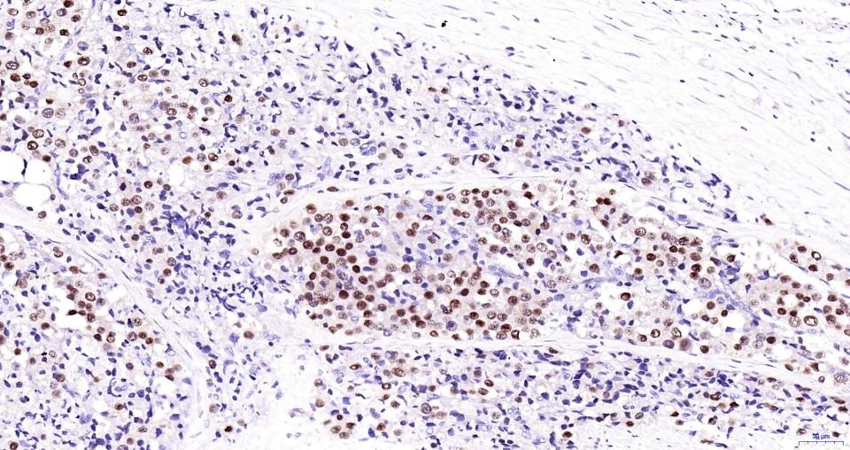 Anti-Androgen receptor Polyclonal Antibody