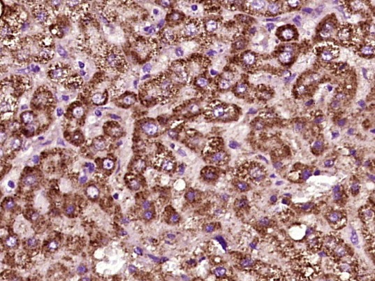 Anti-Angiopoietin-1 Polyclonal Antibody