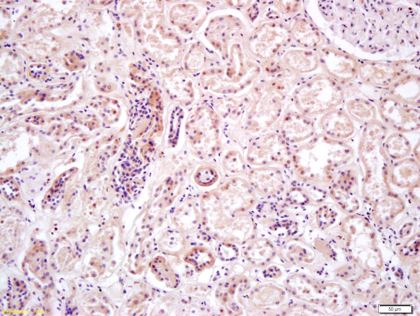 Anti-AMPK alpha 2 Polyclonal Antibody