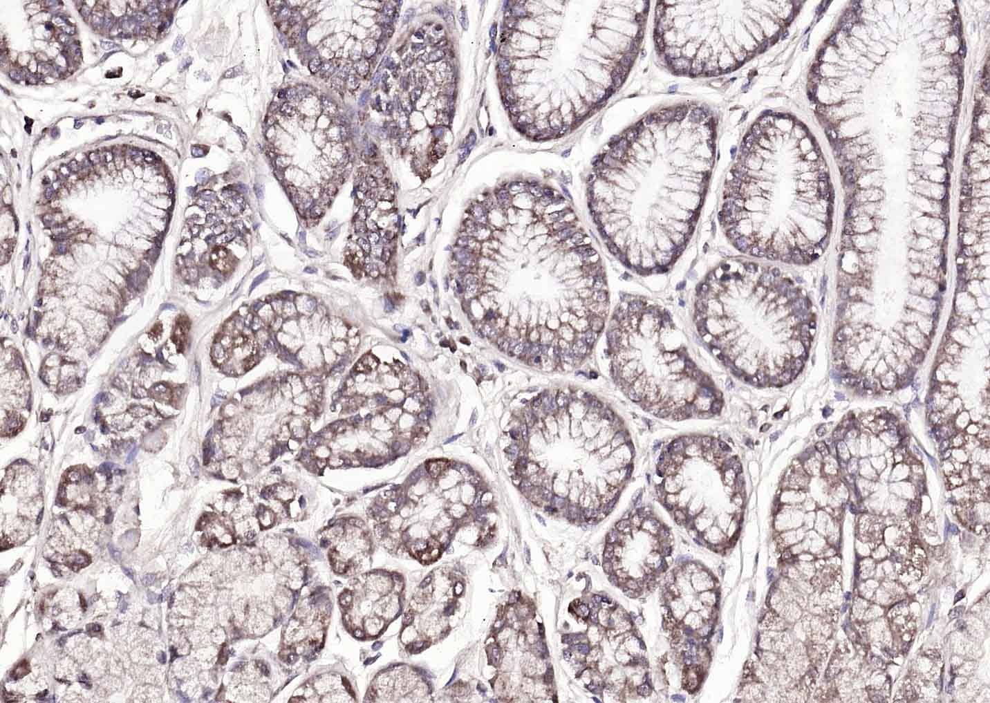 Anti-Amphiregulin Polyclonal Antibody