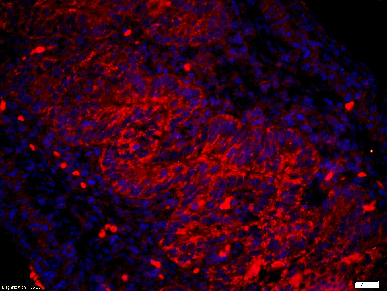 Anti-Amphiregulin Polyclonal Antibody