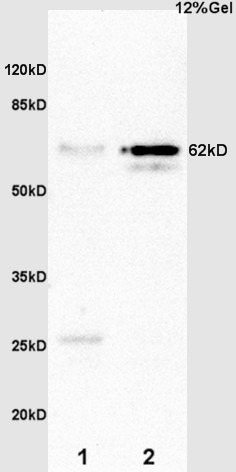 Anti-AMPK alpha 2 Polyclonal Antibody