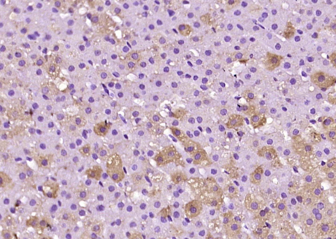 Anti-Adrenodoxin Polyclonal Antibody