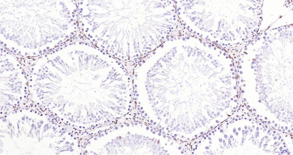 Anti-Androgen receptor Polyclonal Antibody